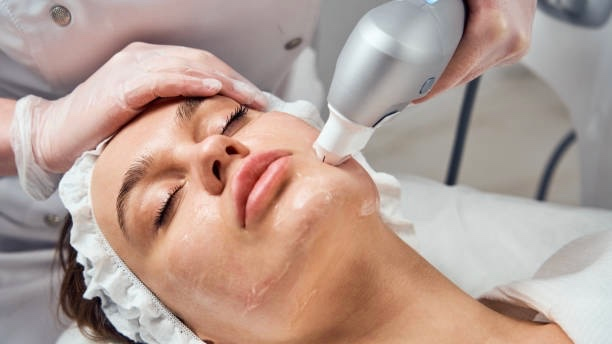 Epilare definitivă Full face