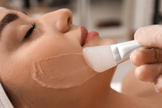 Peeling chimic