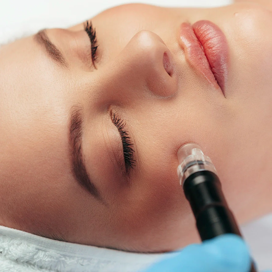 Microneedling cu Hydrapen